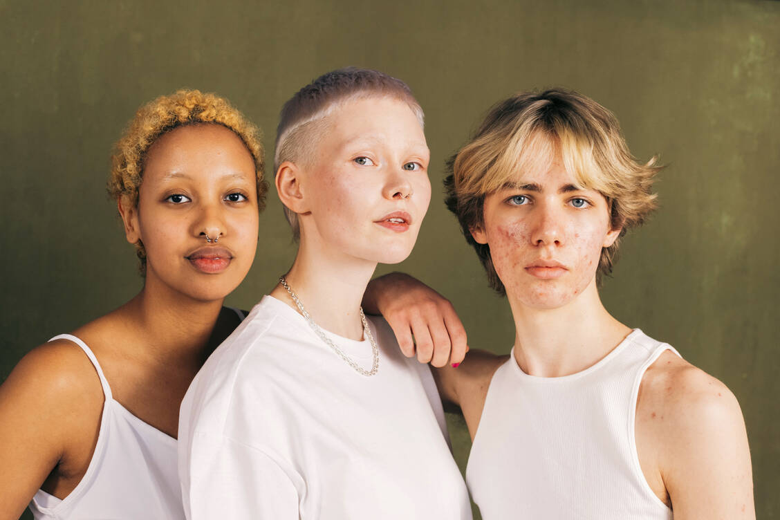 Pubert-t-Die-Haut-im-hormonellen-Wandel