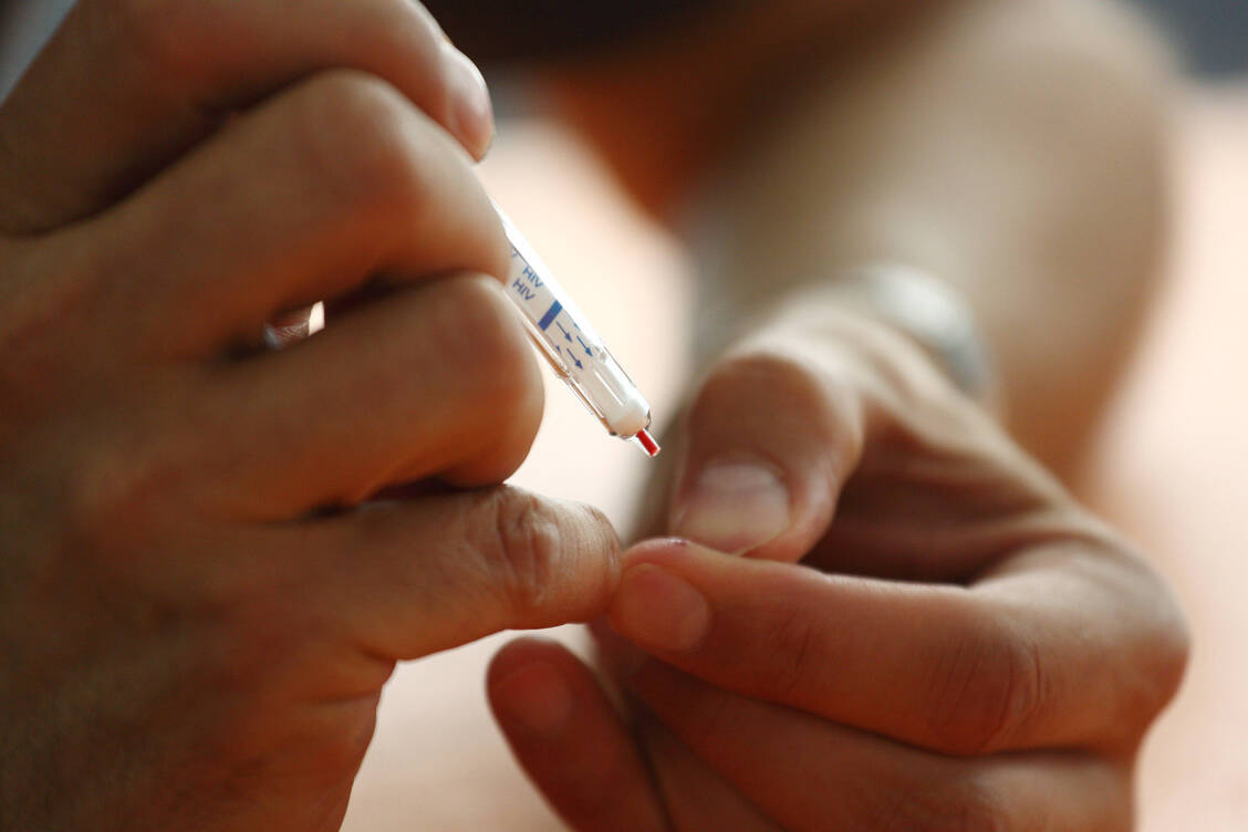 Neuer-Bericht-HIV-Erkrankungen-in-Europa-oft-erst-sp-t-erkannt
