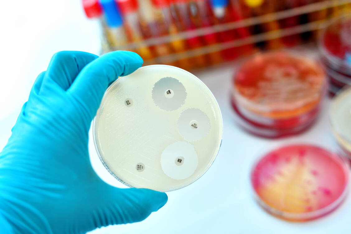 Antibiotikaresistenz-Mit-der-richtigen-Reihenfolge-zum-Erfolg