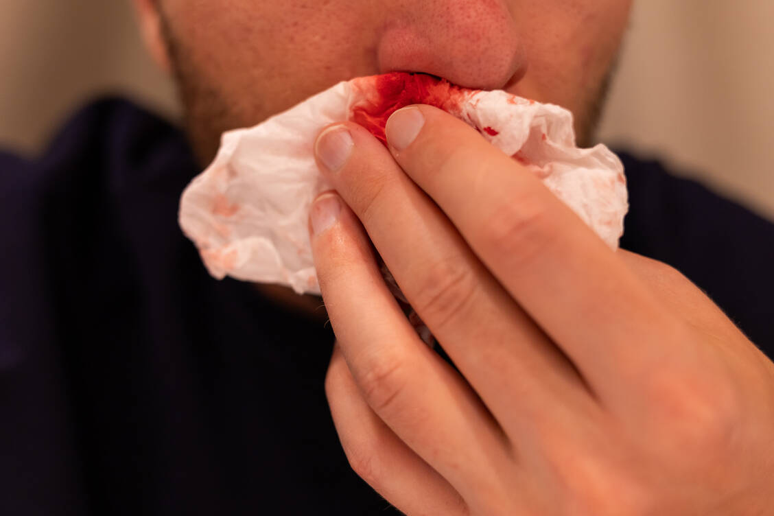 Tipps-und-Warnzeichen-Was-hilft-bei-Nasenbluten-