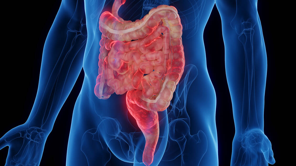 Chronisch-entz-ndliche-Darmerkrankungen-Neuere-Therapeutika-gut-akzeptiert