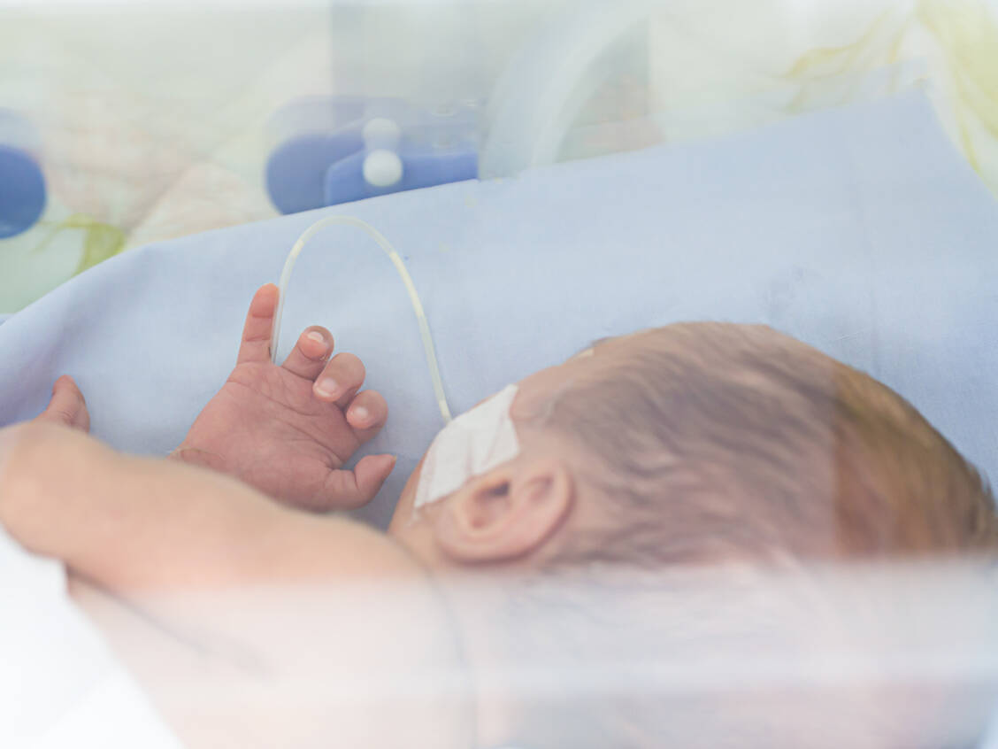 Hypophosphatasie-F-r-Babys-potenziell-lebensbedrohlich