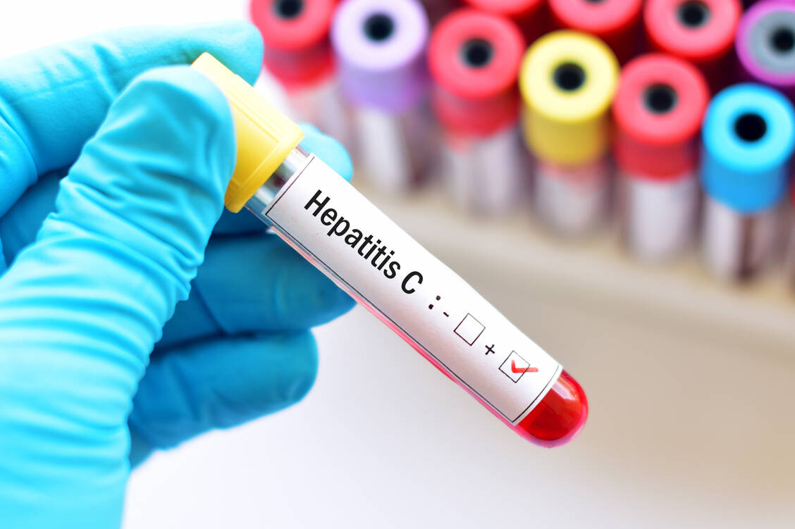 RKI-Bericht-Hepatitis-C-wird-in-Deutschland-seltener