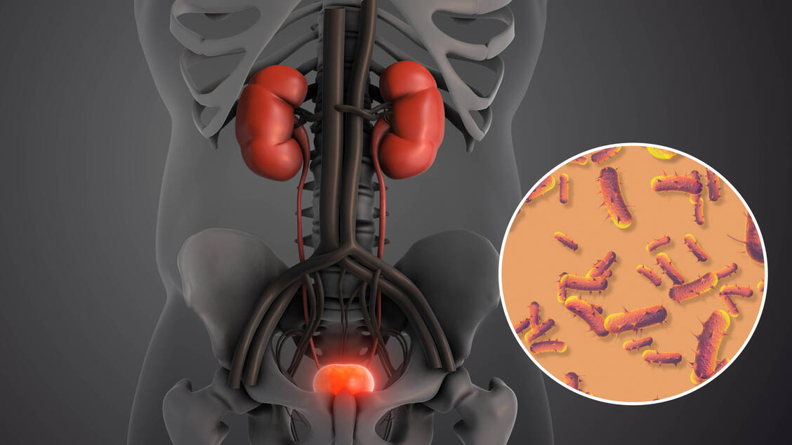 Neues-Antibiotikum-FDA-l-sst-erstes-orales-Carbapenem-zu