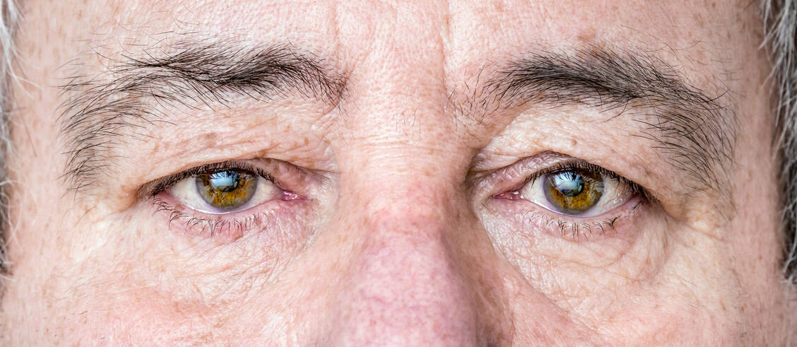 Tumoren-am-Augenlid-Systemtherapie-vor-oder-anstatt-OP