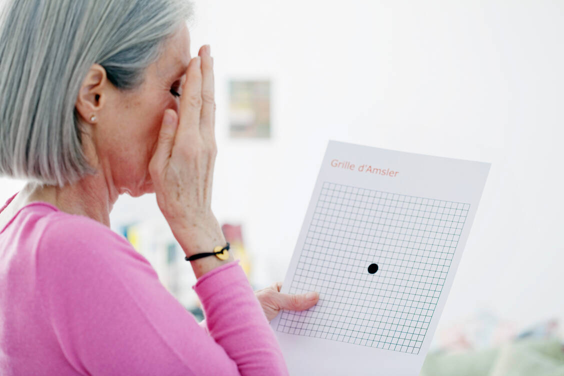 Beobachtungsstudie-Erh-htes-Krebsrisiko-bei-AMD-