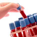 Prothrombintest �berf�hrt Heparin-F�lschungen