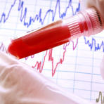 Blick ins Blut: Mikro-RNA als Krankheits-Marker