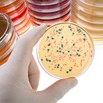 Resistenzen sind �lter als Antibiotika