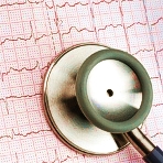 Vernakalant: Neues Antiarrhythmikum auf dem Markt