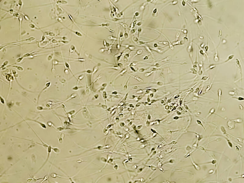 Das Spermiogramm als Marker fr Gesundheit