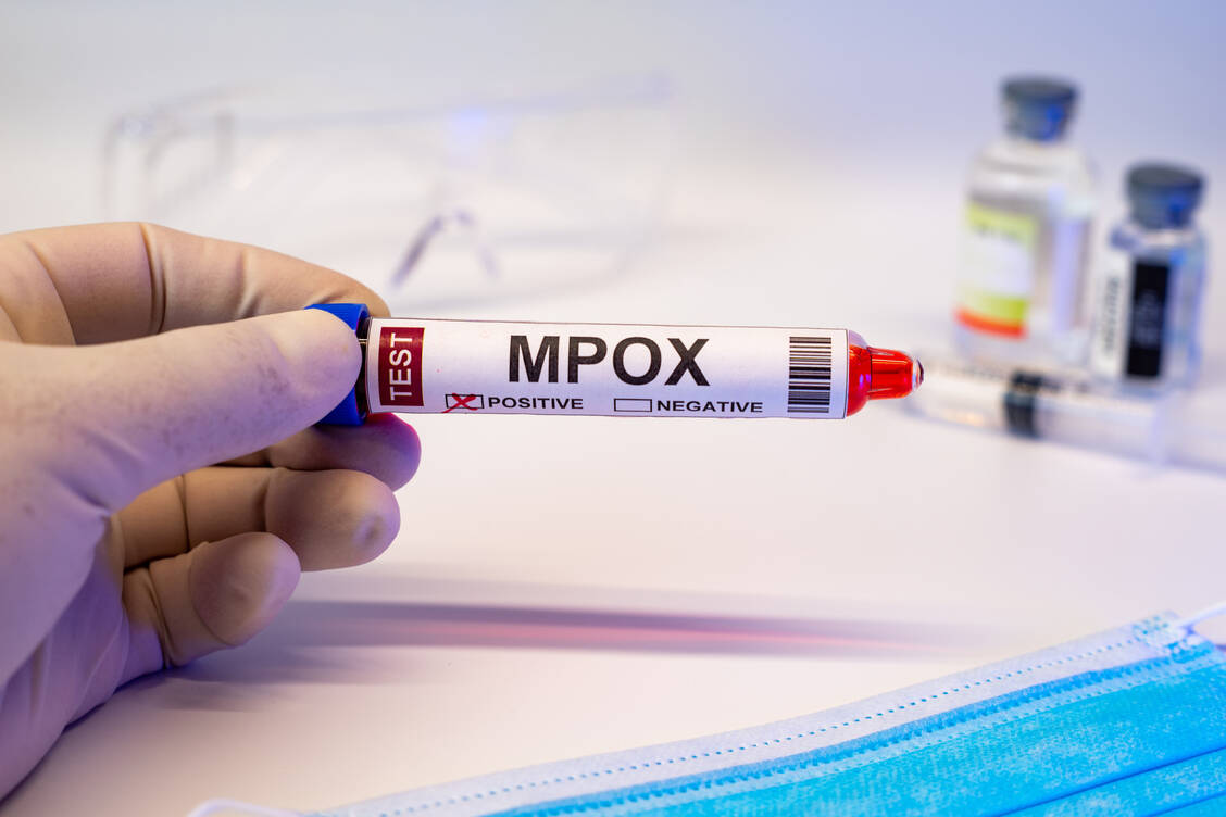 Erstmals ist in Deutschland die neue Variante des Mpox-Virus nachgewiesen worden. / © Adobe Stock/JUN LI