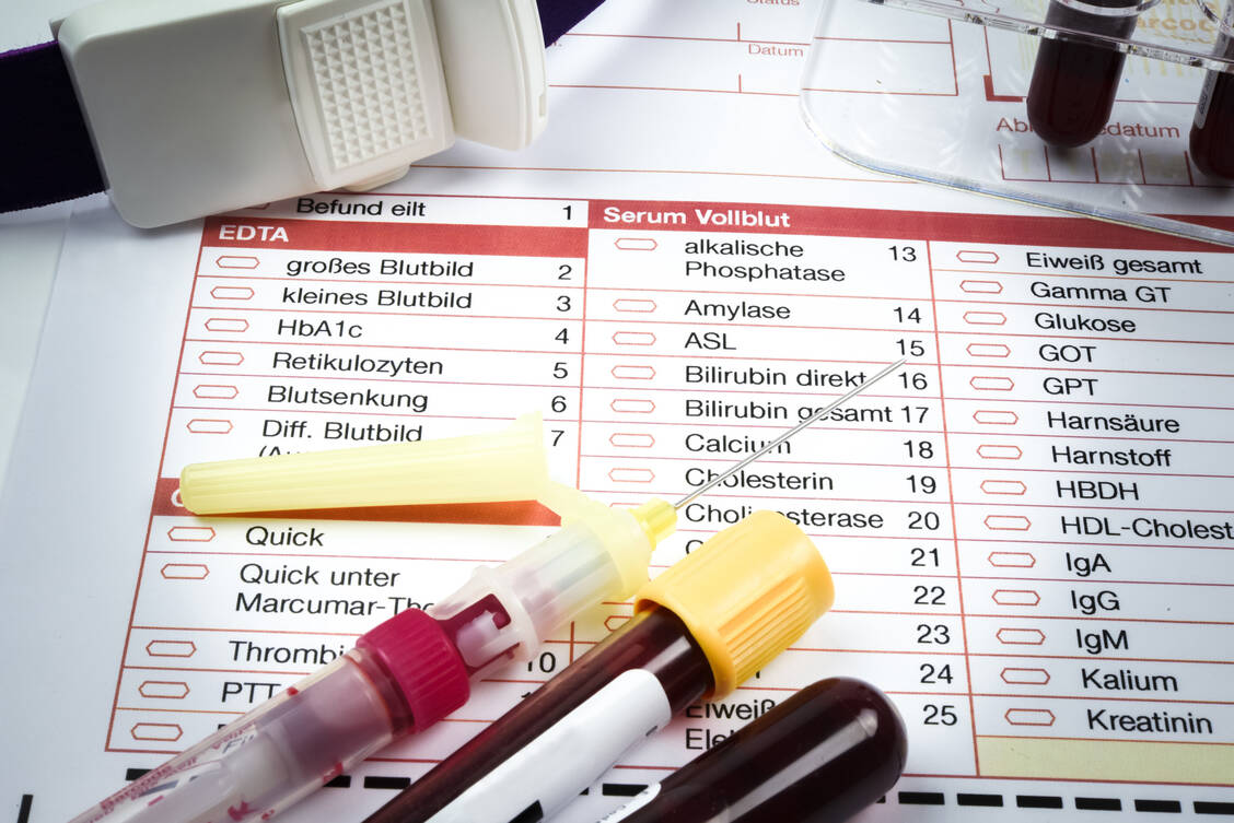 Hinweise auf einen Morbus Paget lassen sich auch im Blut finden.  / © Adobe Stock/Countrypixel