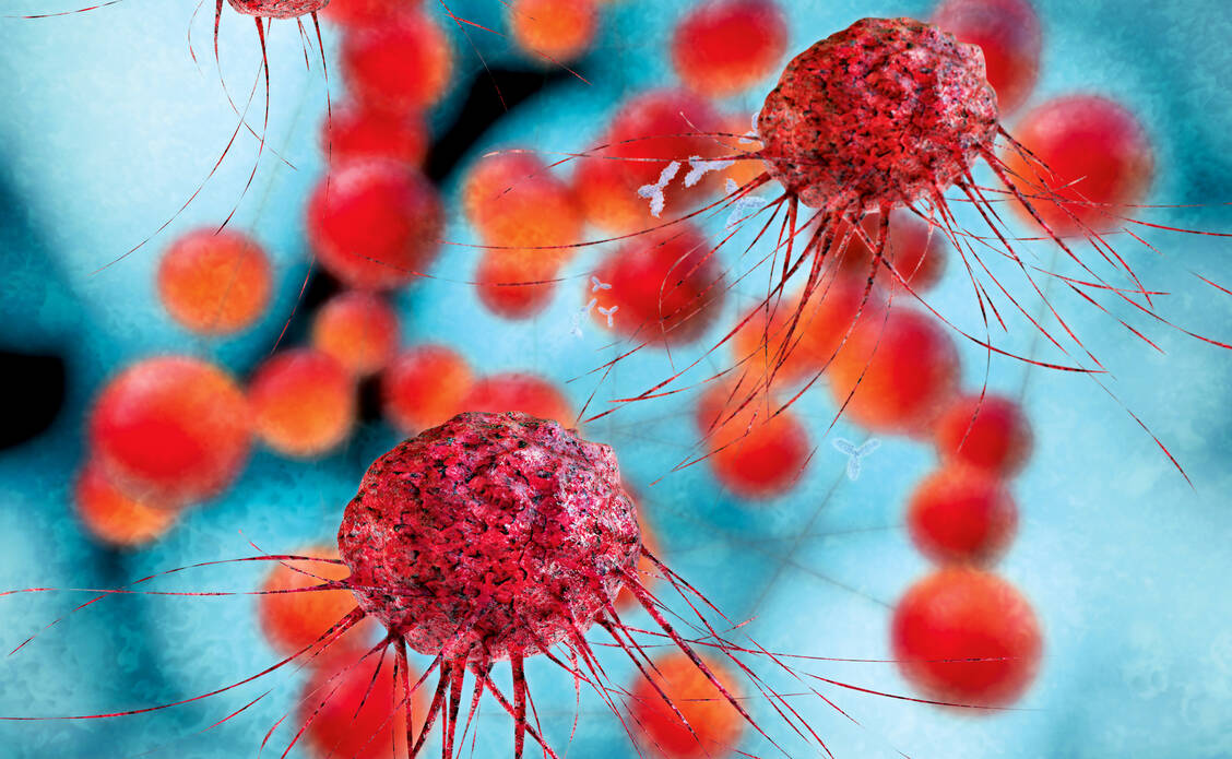 Krebs ist nach Herz-Kreislauf-Erkrankungen die zweithäufigste Todesursache in Deutschland. Mit personalisierten Immuntherapien wollen die Mainzer Forscher des neuen Hi-Tron-Institutes die Behandlung von Krebs schonender und effizienter für Patienten gestalten..  / Foto: Fotolia/fotoliaxrender