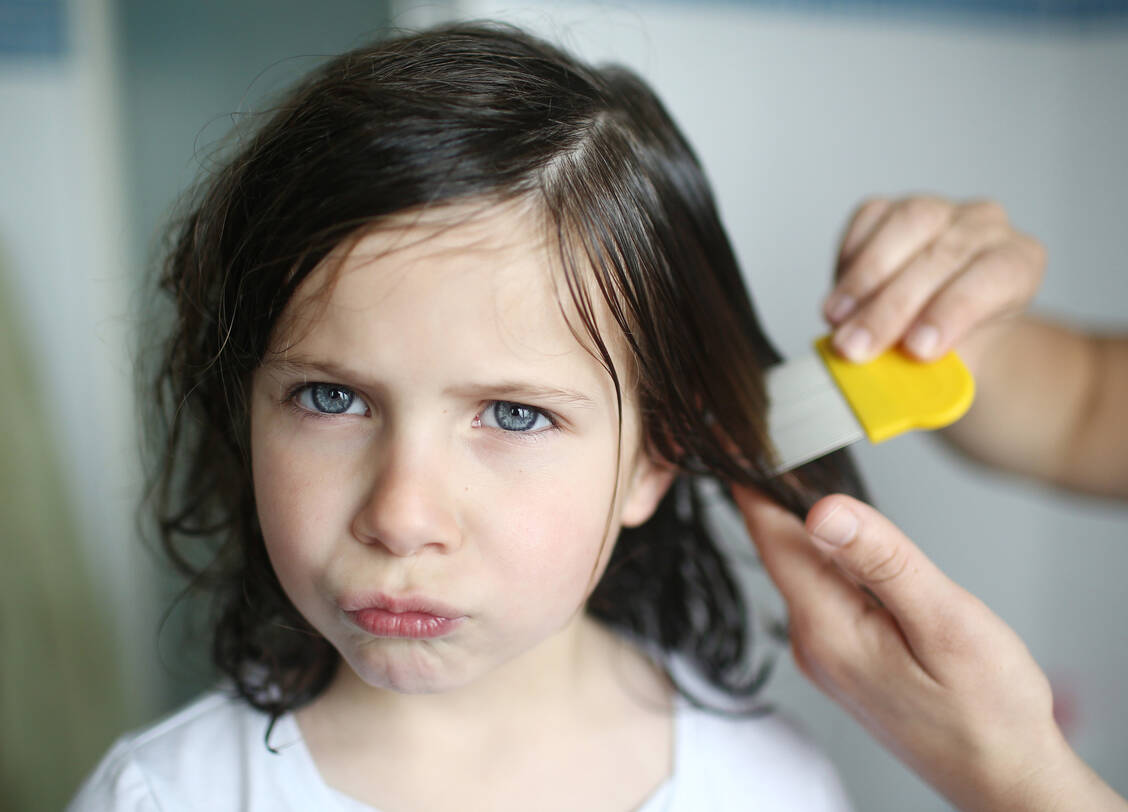 Das wirksamste Vorgehen gegen Kopfläuse kombiniert eine wiederholte Behandlung mit einem Kopflausmittel mit Auskämmen. / © Getty Images/Catherine Delahaye