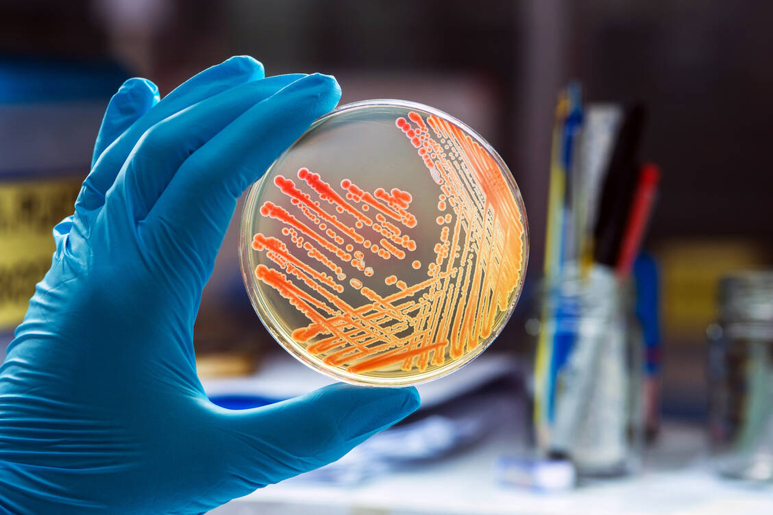Vor dem Hintergrund zunehmender Resistenzen erlebt das β-Lactam-Antibiotikum Temocillin ein Comeback. / Foto: Adobe Stock/analysis121980