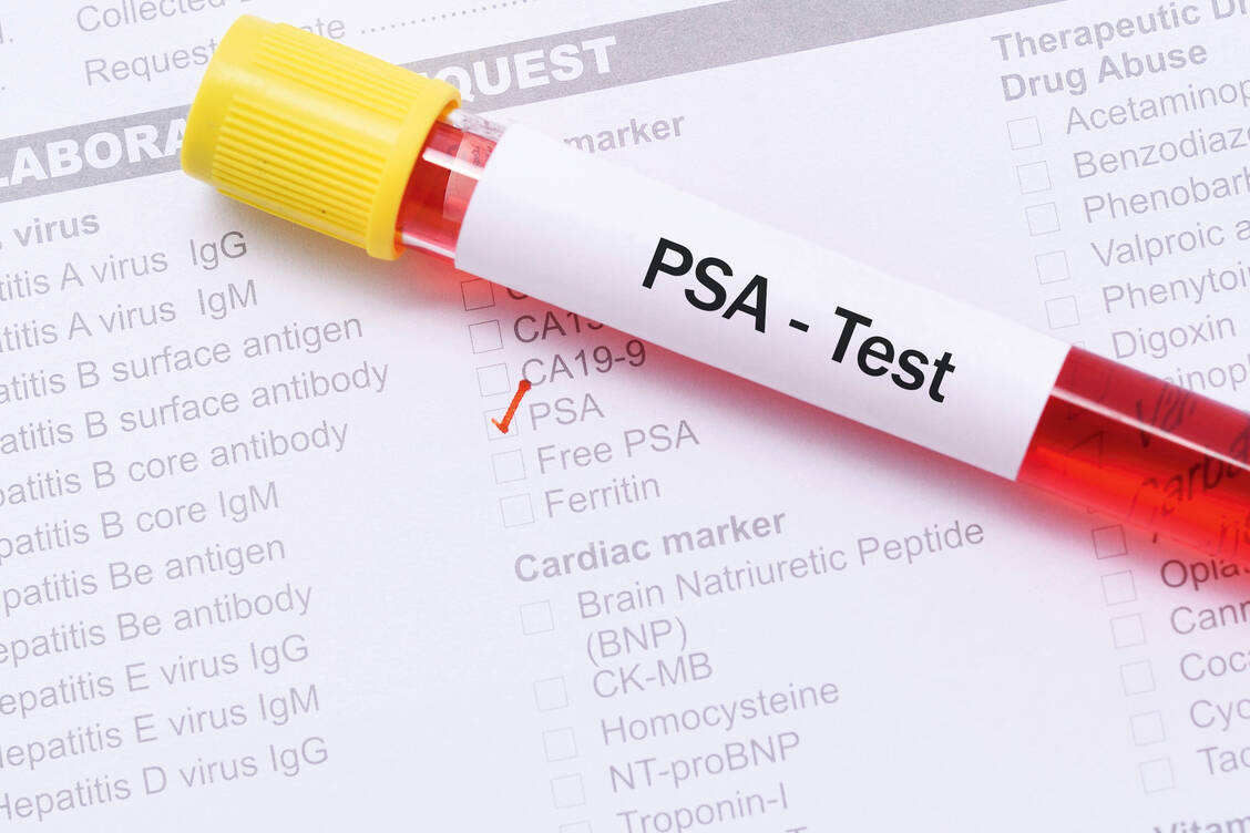 Ein Anstieg des PSA-Werts trotz Androgen-Entzugstherapie kann ein erneutes Wachstum eines Prostata-Tumors anzeigen.   / Foto: Fotolia/jarun011