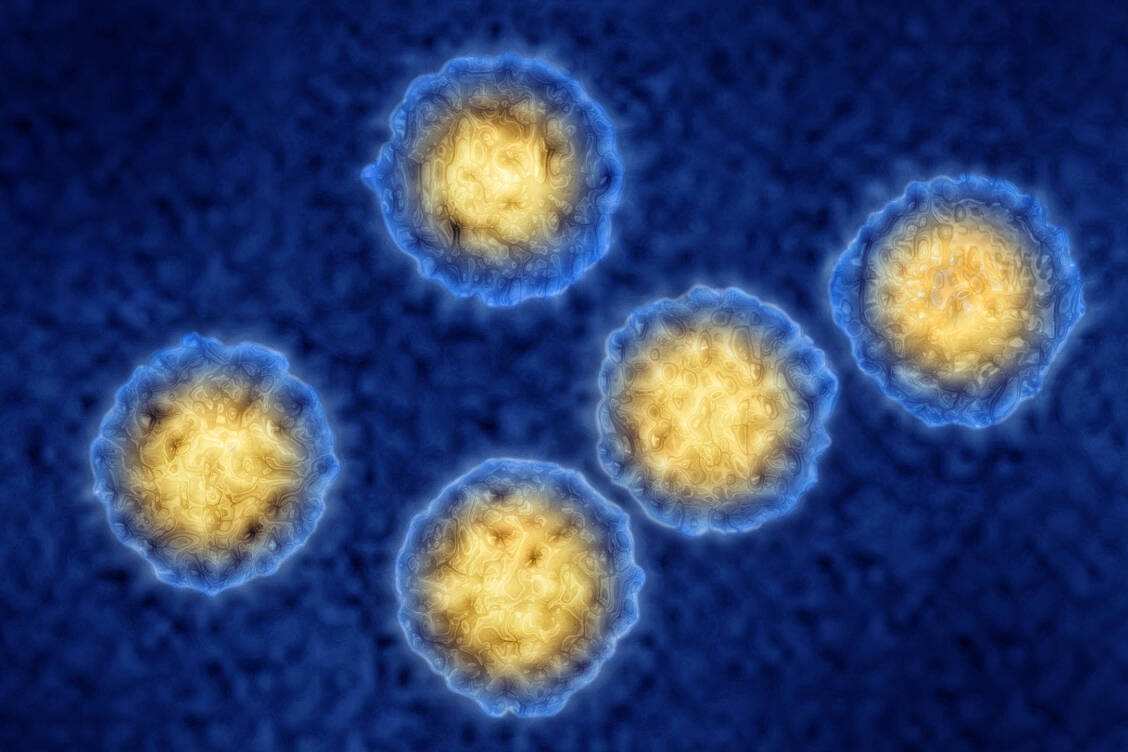 Das Cytomegalievirus ist ein behülltes, doppelsträngiges DNA-Virus aus der Familie der Herpesviridae. / Foto: Picture Alliance/BSIP