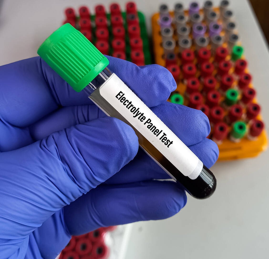 Bei Verdacht auf eine Elektrolytstörung sollten die Konzentrationen der wichtigsten Ionen im Plasma oder Serum gemessen werden. / Foto: Adobe Stock/MdBabul