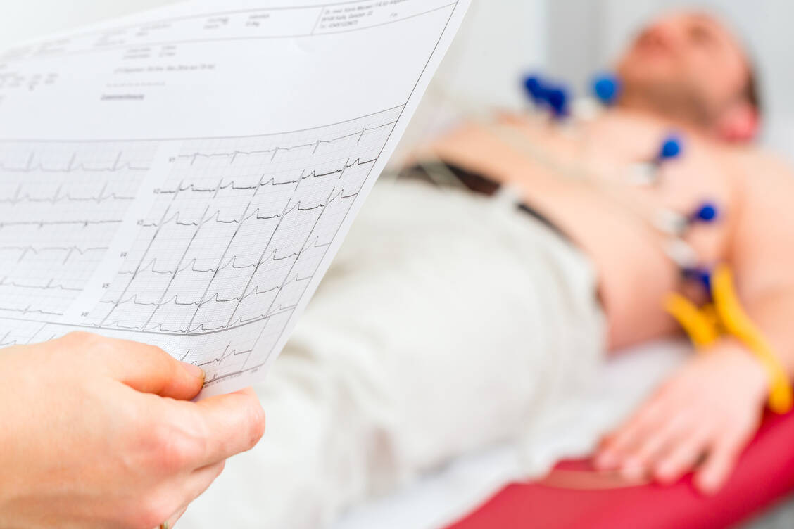 Diltiazem ist ein Blutdrucksenker und auch ein Antiarrhythmikum. / © Adobe Stock/Kzenon