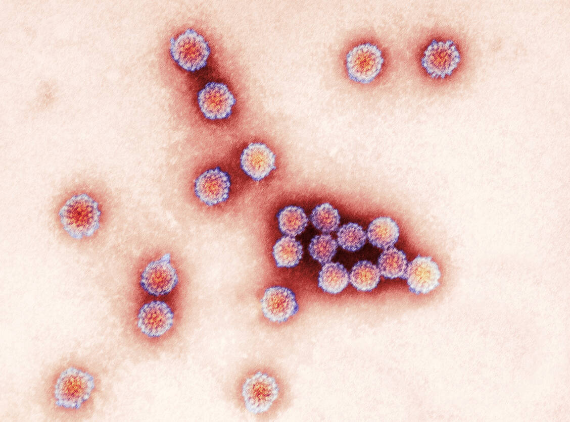 Warzen-Urheber: Von den mehr als 100 verschiedenen Typen an humanen Papillomaviren können einige Warzen auslösen. / Foto: Science Photo Library/ Public Health England/Centre for Infections