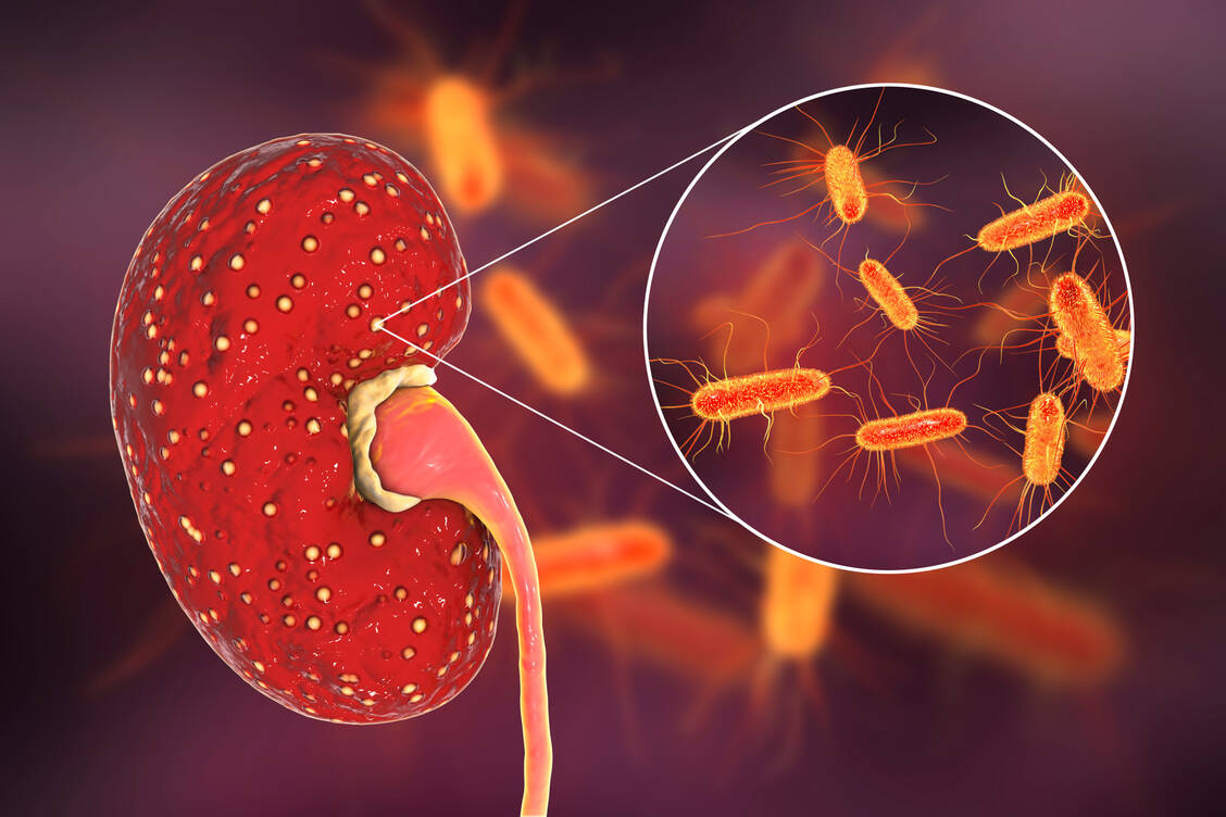 Unter anderem zur Pyelonephritis-Therapie soll die Fixkombination aus Cefepim und Enmetazobactam nach der Zulassung zum Einsatz kommen. / Foto: Adobe Stock/Dr_Microbe