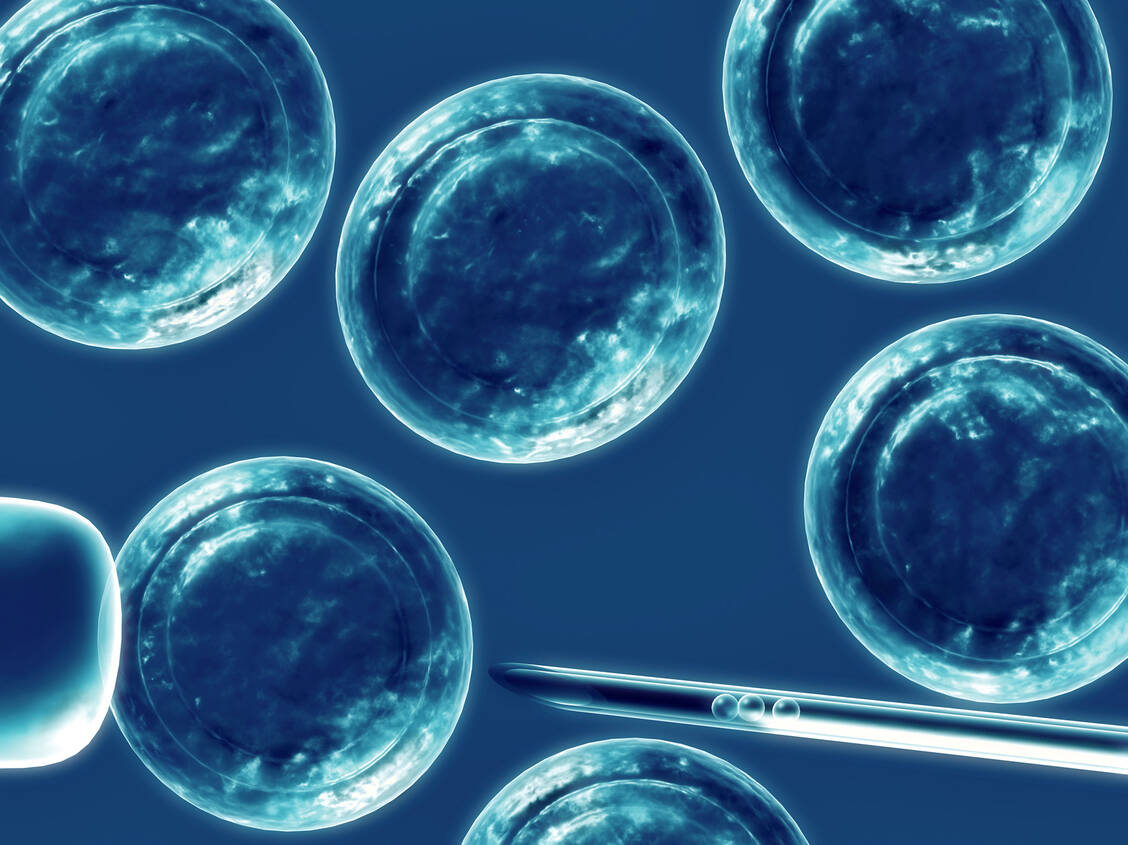 Aus pluripotenten Stammzellen lassen sich Kardiomyozyten gewinnen, aus denen Forscher, eine Art lebendes Pflaster für Herzinfarkt-Narben herstellen. / Foto: Shutterstock/Sebastian Kaulitzki
