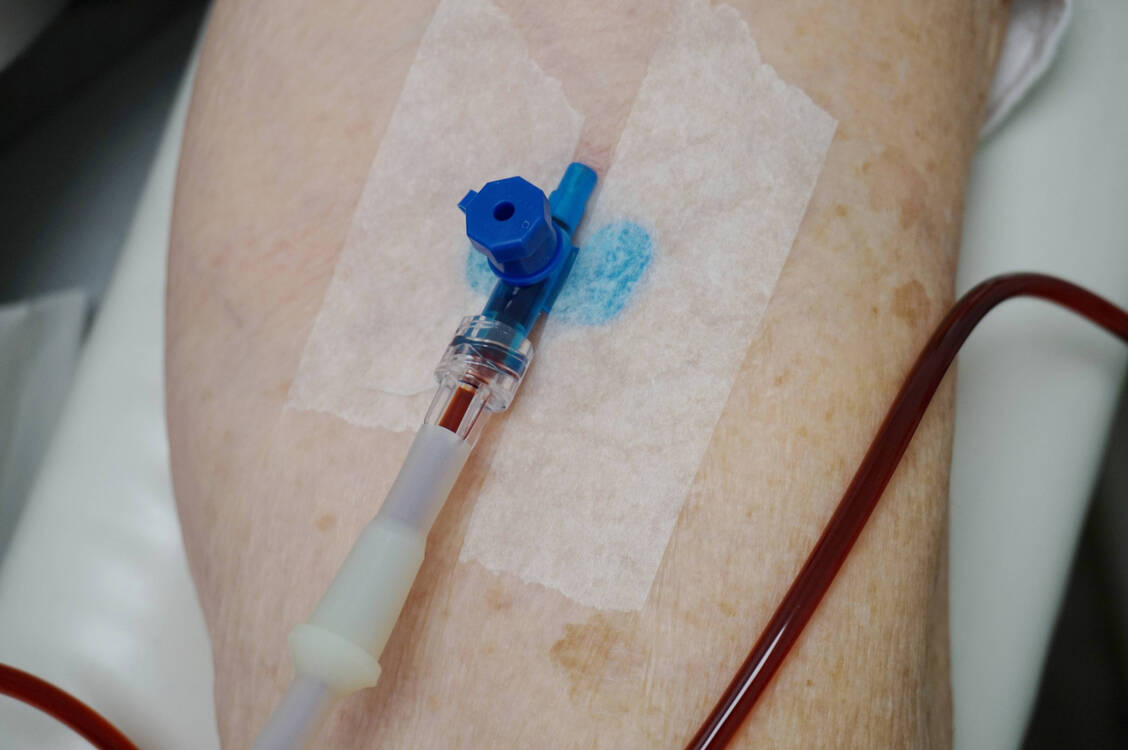 Eine präoperative Eiseninfusion beeinflusst die Genesung von anämischen Patienten nach einer Herz-OP positiv – unabhängig von deren Eisenstatus. / © Imago / Geisser