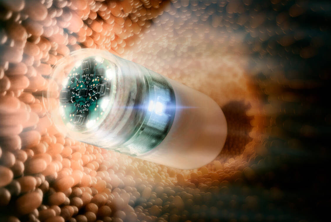 Hightech auf kleinstem Raum enthält die neue Kamerakapsel Endotrace, die unter Beteiligung deutscher Forscher entwickelt wurde. / Foto: Fraunhofer IZM/Volker Mai