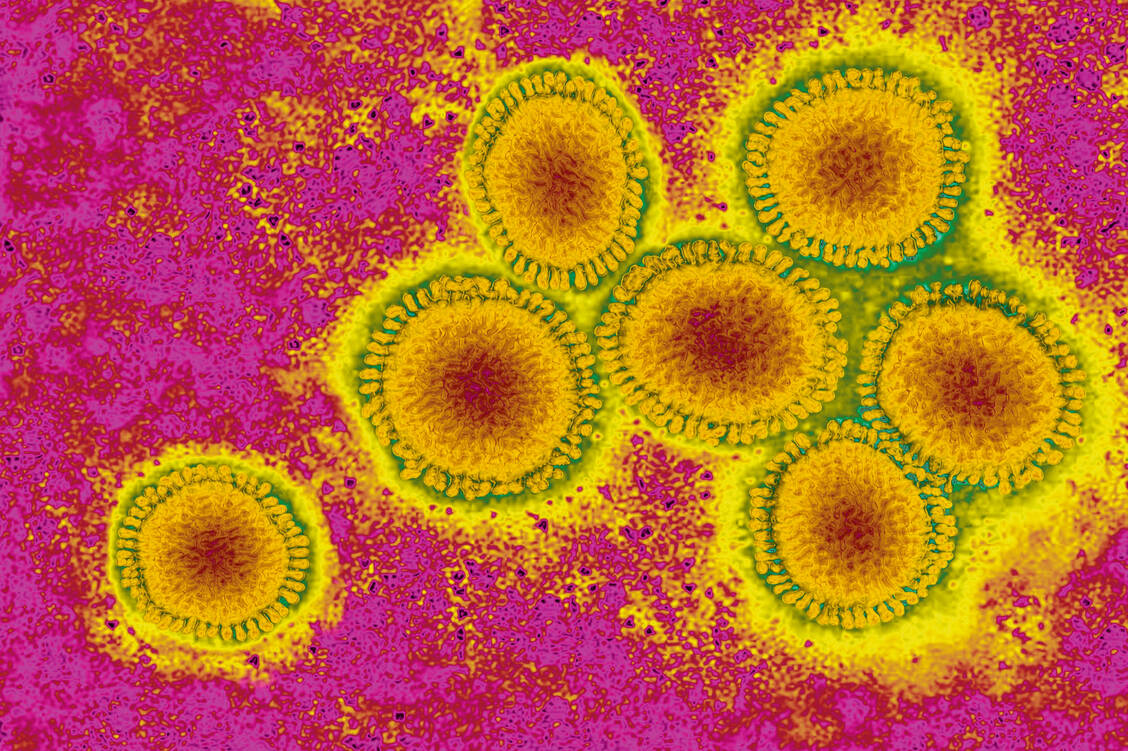 Elektronenmikroskopische Aufnahme von Influenza-Viren. Der genaue Stamm und Subtyp wird genetisch bestimmt. / Foto: dpa