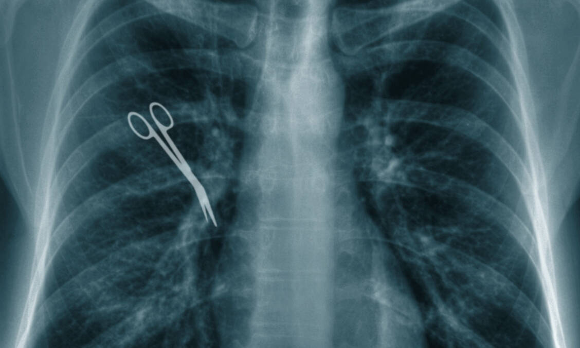Nicht immer sind Behandlungsfehler so offensichtlich. Der Medizinische Dienst der Krankenkassen prüft Patientenbeschwerden über mutmaßliche Behandlungsfehler. Heute hat der MDK die Zahlen für 2018 bekanntgegeben.  / Foto: Fotolia/Lukasz Panek