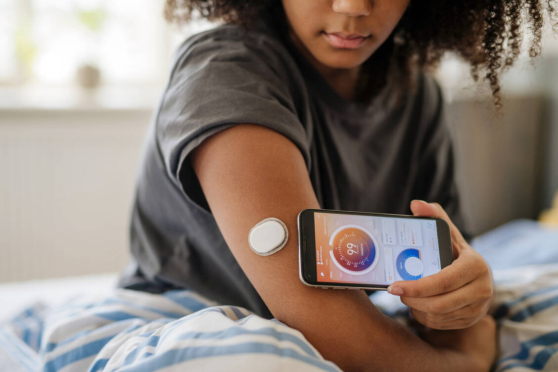 Wearables sollen zunehmend auch biochemische Marker messen. Beim kontinuierlichen Glucosemonitoring ist das bereits gelungen: Hier wird die Glucosekonzentration in der interstitiellen Flüssigkeit gemessen. / © Getty Images/Halfpoint Images