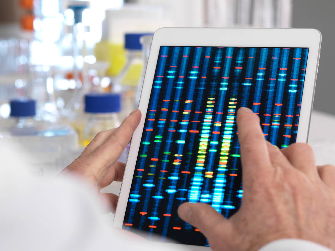 Der eigentliche Gentest wird im Labor durchgeführt, die Interpretation bleibt speziell geschulten Apothekern und Ärzten vorbehalten (Symbolbild). / Foto: Science Photo Library