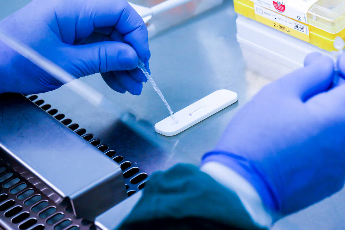 Mit einem Antikörpertest wie hier lässt sich nachweisen, ob jemand eine SARS-CoV-2-Infektion durchgemacht hat. Für die Impfstoffstudien werden jedoch umfangreichere Tests zur Antikörperbildung gemacht, auch quantitativ. / Foto: UKE