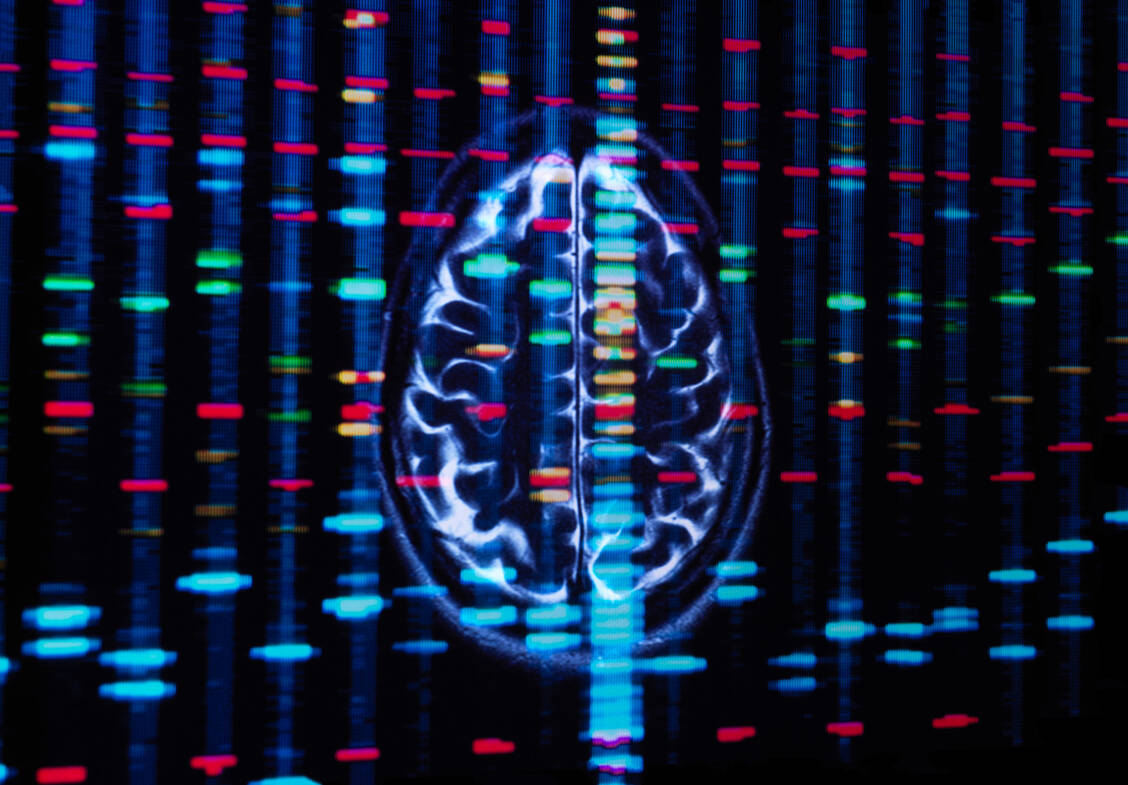 Ist APOE4 lediglich ein Risikofaktor für sporadisch auftretende Alzheimer-Demenz oder definiert das Allel eine eigene genetische Form der Erkrankung? Hierüber hat eine aktuelle Publikation eine Diskussion in der Fachwelt angestoßen. / Foto: Getty Images/Science Photo Library