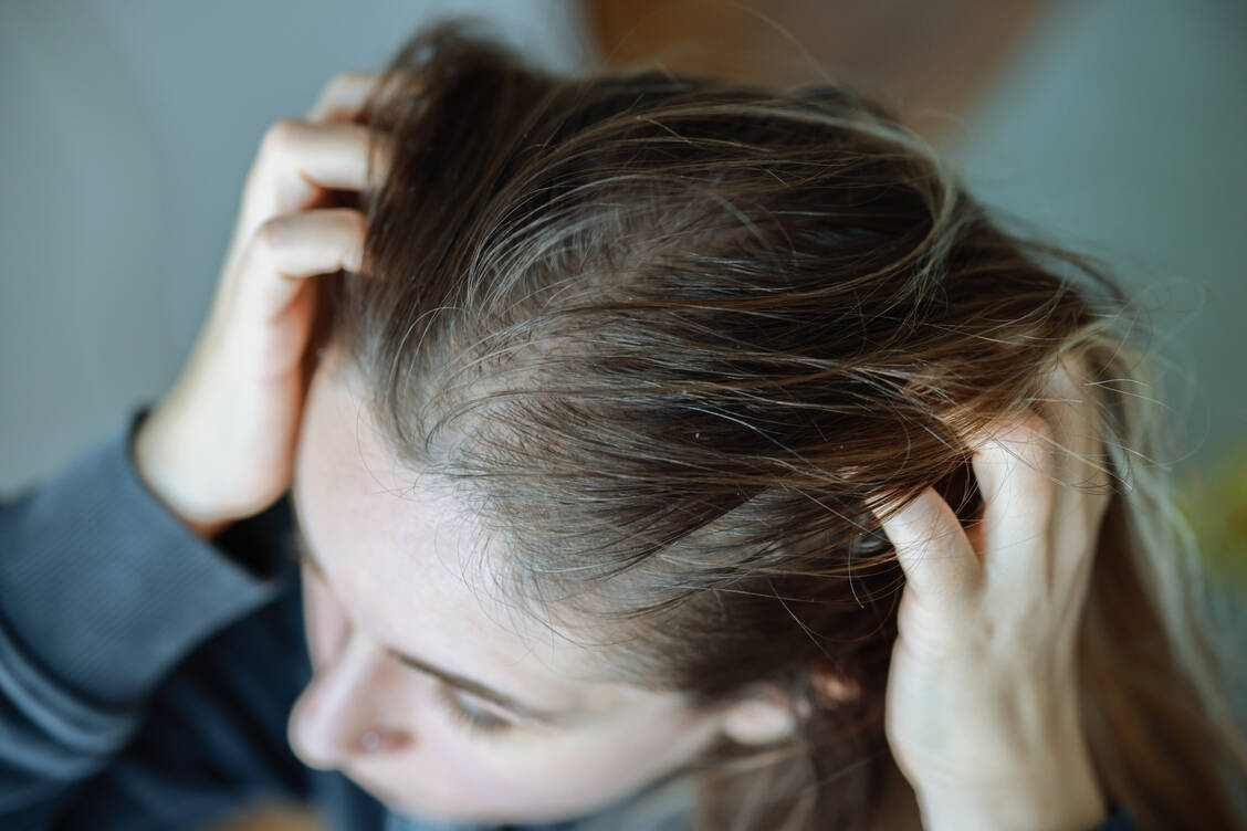 Verschiedene Erkrankungen können eine Kopfhautreizung verursachen. Bevor ein Präparat zur Selbstmedikation abgegeben wird, muss daher geklärt werden, ob diese überhaupt möglich ist. / © Getty Images/ozgurcankaya