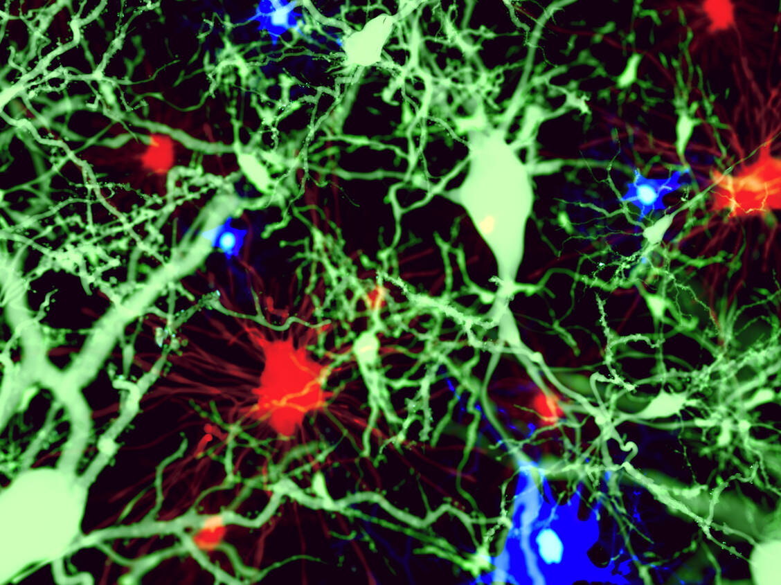 Es wird vermutet, dass Gliazellen im Gehirn an der Entstehung von Alzheimer beteiligt sind. Foto: Shutterstock/Juan Gaertner
