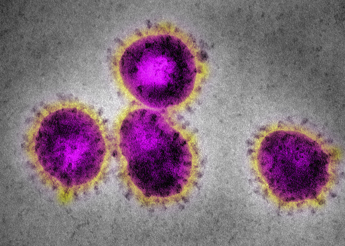 SRAS-CoV-2-Viren produzieren ein verkürztes ORF3b-Protein, das offenbar effektiv die Typ-I-Interferon-Antwort hemmt. / Foto: Getty Images/Kallista Images