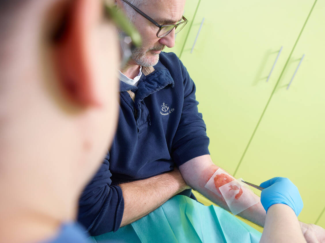 Bei Verbrennungen kommen beispielsweise Hydrogele, antibakterielle Wundauflagen oder Wundgitter zum Einsatz, die die Wunde feucht halten und die Wundheilung unterstützen. / © BVMed