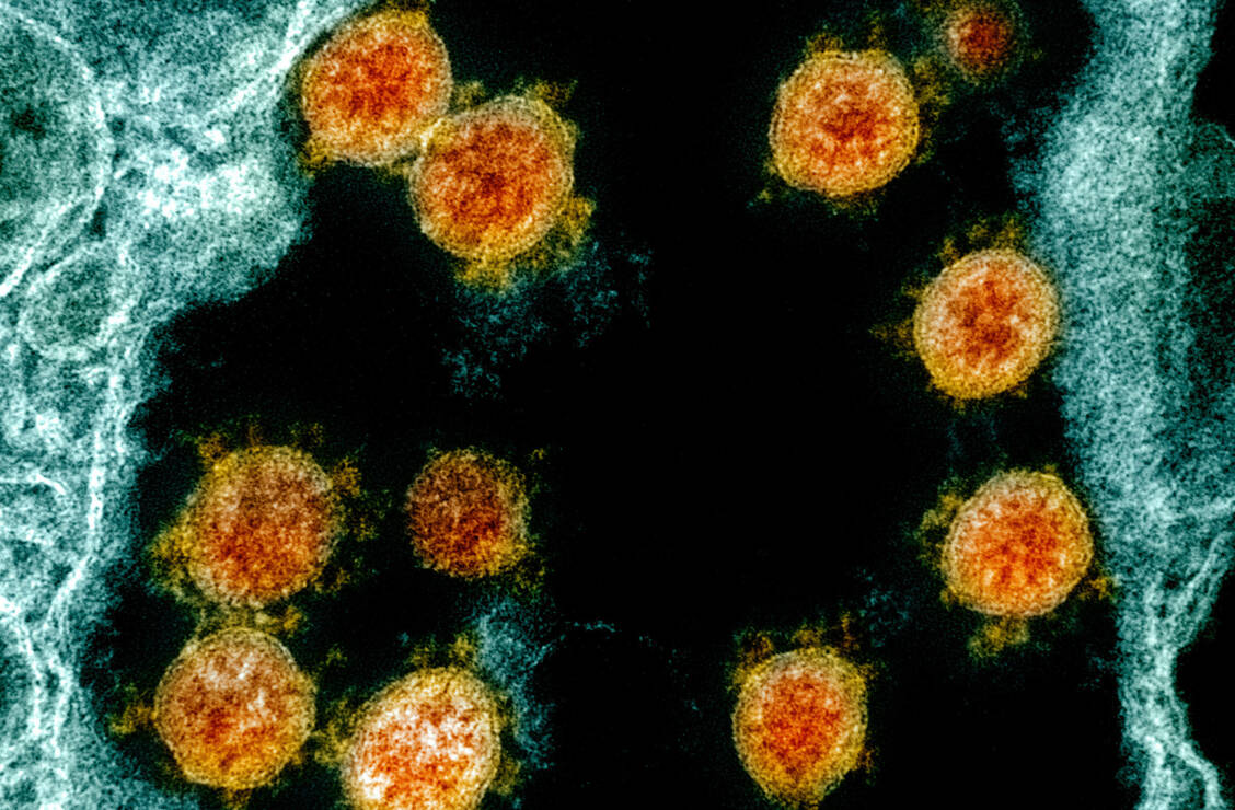 Molnupiravir unterdrückt die Virusvermehrung und ist deshalb im frühen Krankheitsverlauf bei Covid-19 am besten wirksam. / Foto: NIH-NIAID