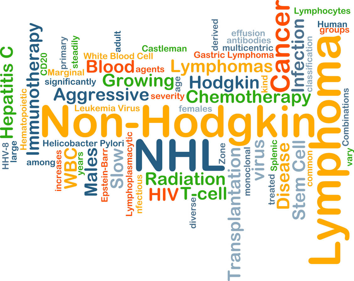Für bestimmte Formen des Non-Hodgkin-Lymphoms gibt es bereits CAR-T-Zelltherapeutika. Bald könnte eine weitere hinzukommen. / Foto: Shutterstock/Kheng Guan Toh