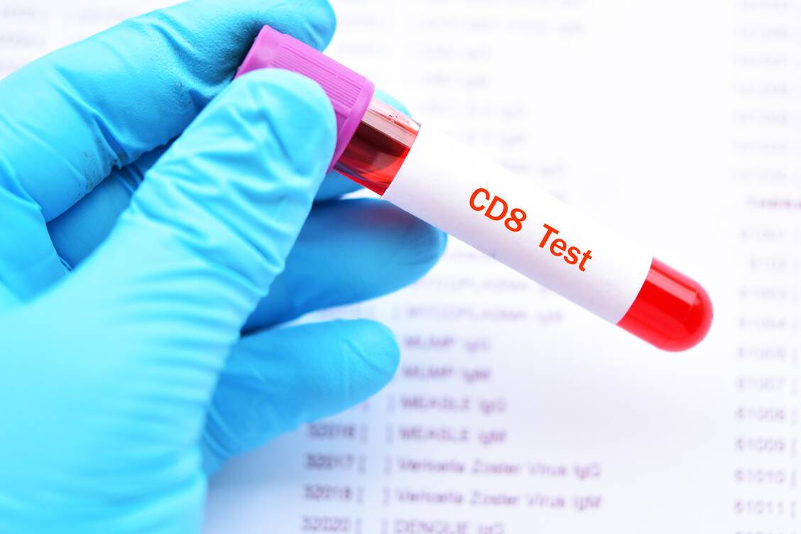 Die Titer spezifischer Gedächtnis-CD8+ T-Zellen könnten Aufschluss darüber geben, wie lang eine Immunität gegen SARS-CoV-2 anhält. / Foto: Getty Images/jarun011