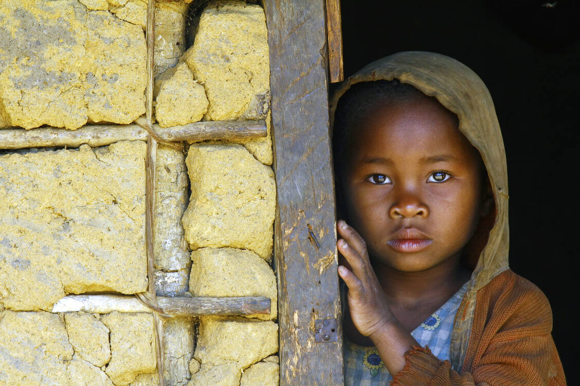 In manchen Regionen werden Mädchen schon in sehr jungen Jahren verstümmelt. / Foto: Fotolia/dr322