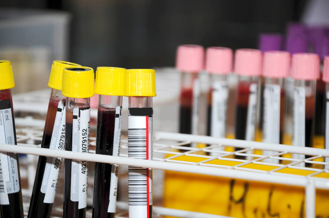Wie ansteckend eine mit dem Coronavirus infizierte Person für andere ist, hängt offenbar auch davon ab, wie kompatibel die Blutgruppen der Beteiligten sind. / Foto: Adobe Stock/littlebell