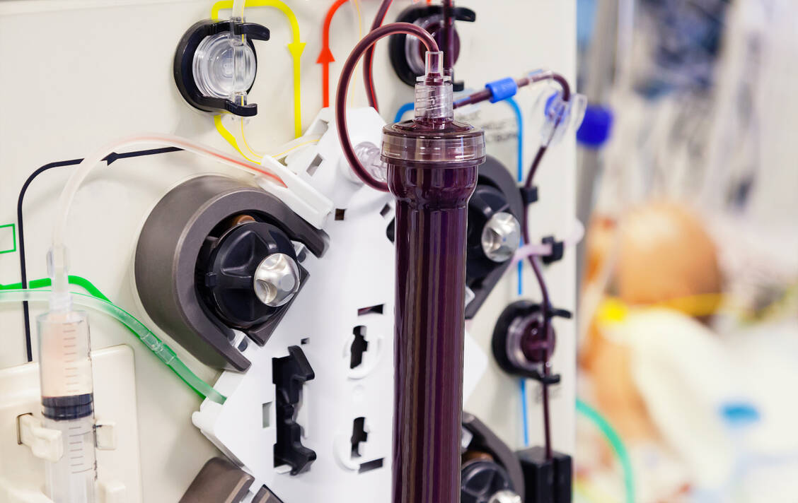Bei der Plasmapherese wird Blut in einem aufwendigen Verfahren außerhalb des Körpers von bestimmten Bestandteilen befreit. / Foto: Adobe Stock/beerkoff