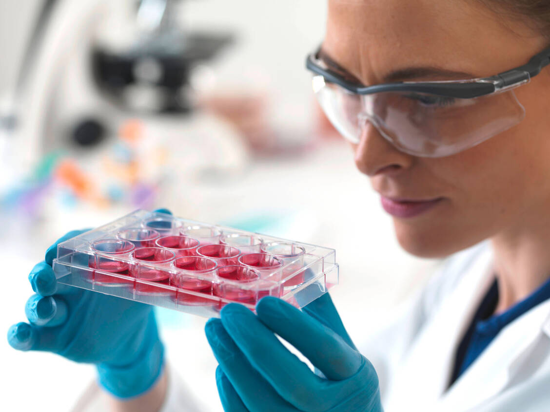 Das therapeutische Potenzial von mesenchymalen Stromazellen wird in zahlreichen weiteren klinischen Studien geprüft, unter anderem zur Behandlung von chronischen Rückenschmerzen aufgrund von Bandscheibendegeneration.  / Foto: Imago/Science Photo Library