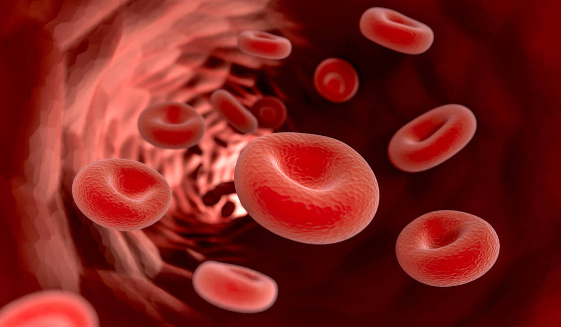 Bei der paroxysmalen nächtlichen Hämoglobinurie geht aufgrund einer Mutation eine wichtige Schutzstruktur auf der Oberfläche der Erythrozyten verloren. Sie werden infolgedessen vom Komplementsystem angegriffen und zerstört. / Foto: Adobe Stock/fotomek