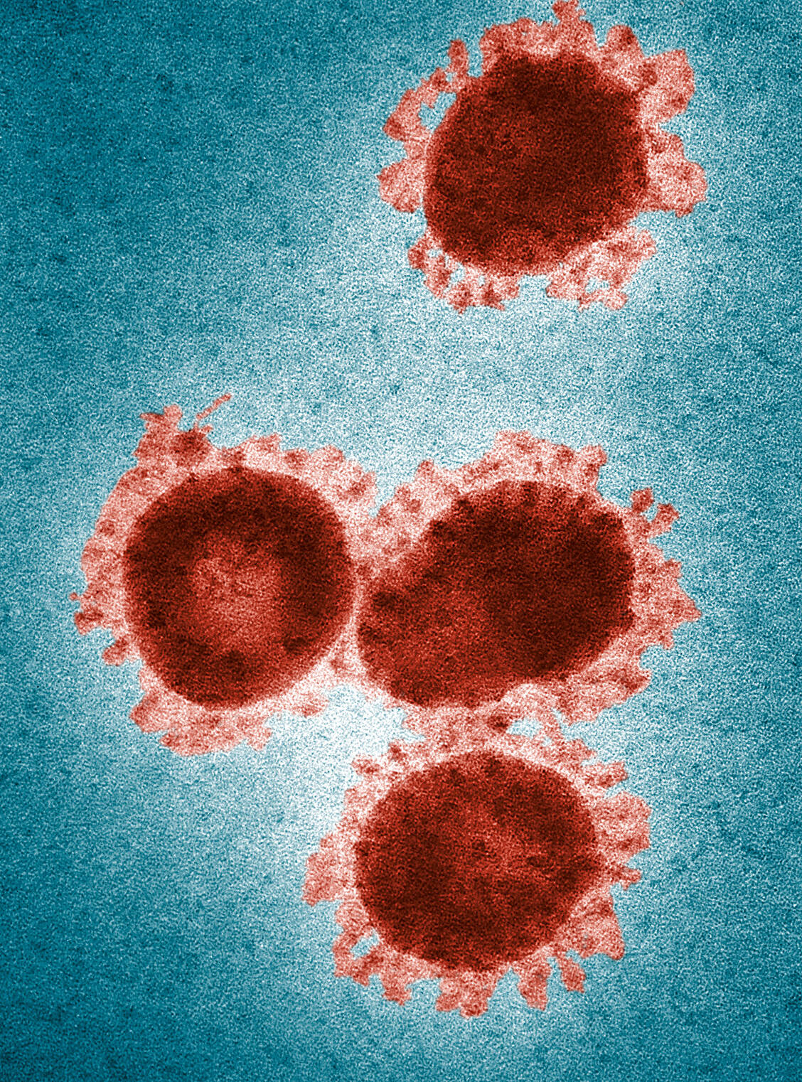 Die Bezeichnung Coronavirus geht auf das kranzförmige Aussehen der Viren zurück ( lateinisch corona: Kranz, Krone). / Foto: CDC/Fred Murphy