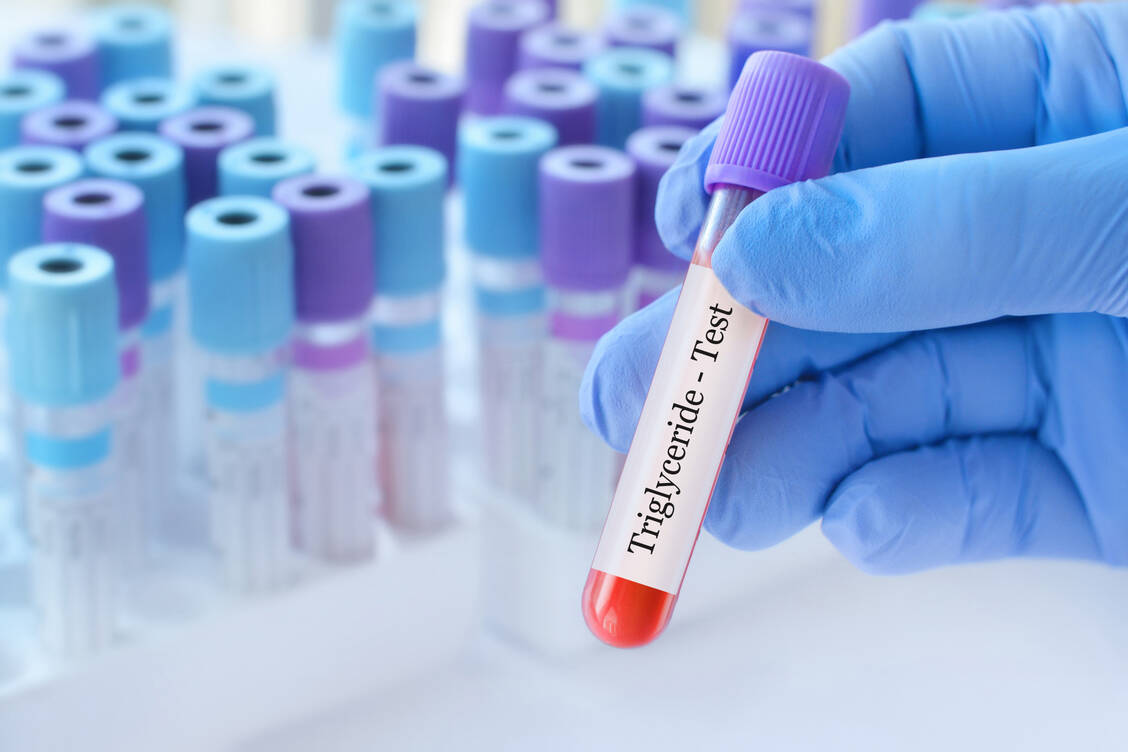 Menschen mit der seltenen Fettstoffwechselerkrankung FCS haben aufgrund eines Gendefekts extrem hohe Triglyceridspiegel. / © Adobe Stock/syhin_stas