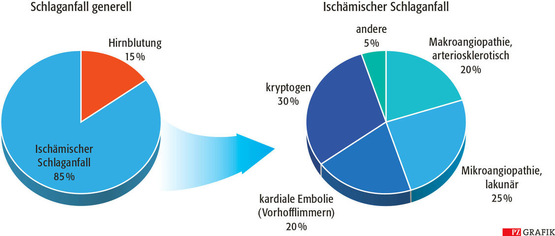 Grafik 1: Subtypen des Schlaganfalls / Foto: PZ/Pfeifer